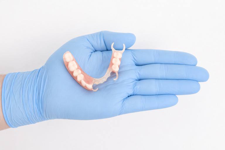 Flexible partial denture by Grimsby Denture Clinic