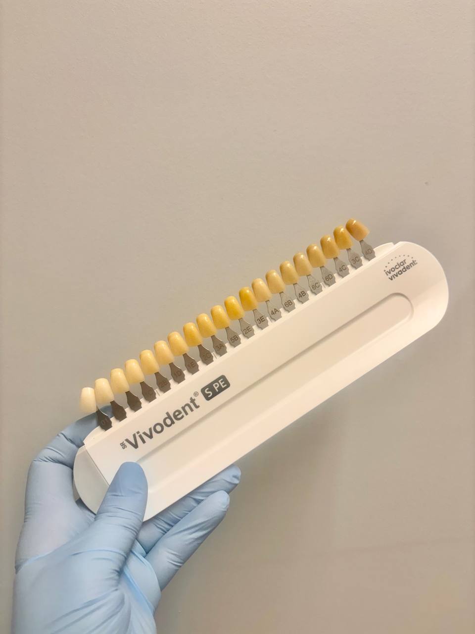 Custom shade matching using the Vivodent shade guide for natural-looking dentures